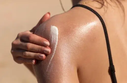 Eine Frau cremt sich die Schulter im Sommer ein