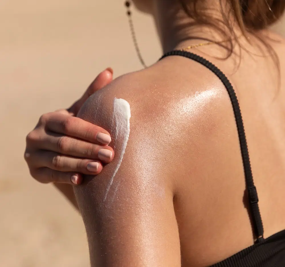 Eine Frau cremt sich die Schulter im Sommer ein